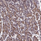 Anti-FN3KRP Antibody