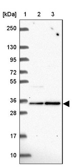 Anti-FN3KRP Antibody
