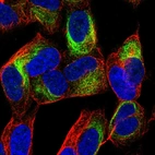Immunofluorescent staining of human cell line SH-SY5Y shows localization to intermediate filaments.