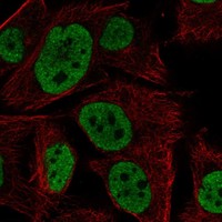 Anti-LRRC75A Antibody