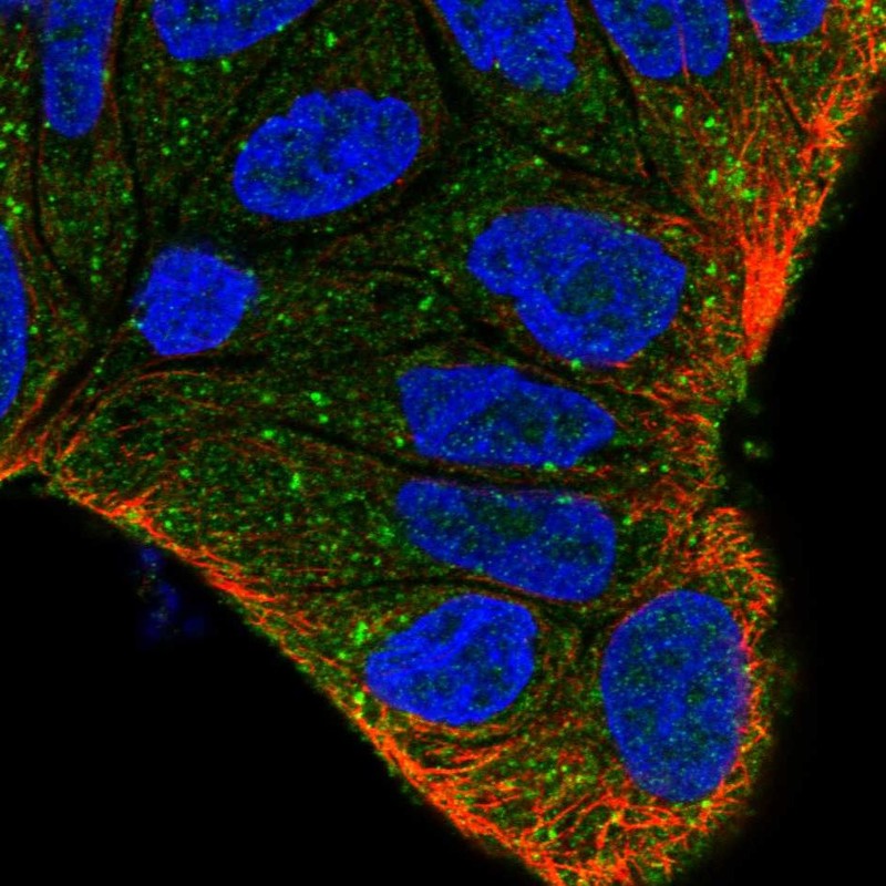 Anti-ZFYVE9 Antibody