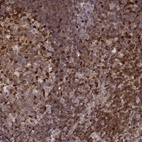 Anti-MFSD1 Antibody