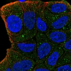 Anti-ZFYVE9 Antibody