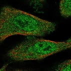 Anti-TXNL4B Antibody