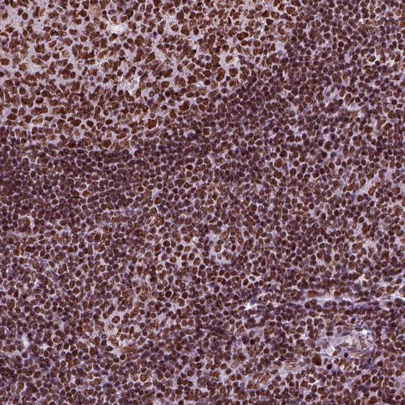 Anti-CBFA2T3 Antibody