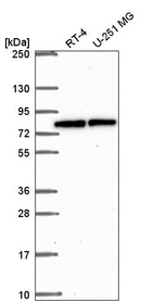 Anti-CBFA2T3 Antibody