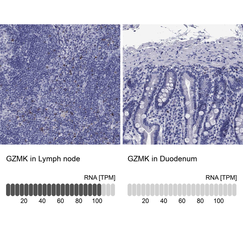 Anti-GZMK Antibody