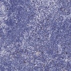 Immunohistochemical staining of human lymph node shows high expression.