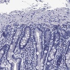 Immunohistochemical staining of human duodenum shows low expression as expected.