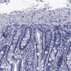 Immunohistochemical staining of human duodenum shows low expression as expected.