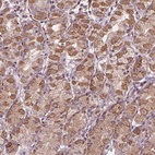 Anti-ORAI2 Antibody