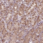 Anti-ORAI2 Antibody