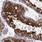 Immunohistochemical staining of human testis shows strong nuclear positivity in cells in seminiferous ducts.