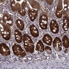 Immunohistochemical staining of human small intestine shows strong nuclear positivity in glandular cells.