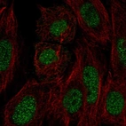 Immunofluorescent staining of human cell line SiHa shows localization to nucleoplasm.