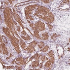 Anti-MIER3 Antibody