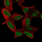 Immunofluorescent staining of human cell line SH-SY5Y shows localization to nucleoplasm.
