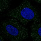 Anti-SLC30A8 Antibody
