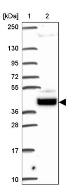 Lane 1: Marker [kDa] 250, 130, 95, 72, 55, 36, 28, 17, 10_br/_Lane 2: Human cell line RT-4