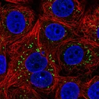 Immunofluorescent staining of human cell line MCF7 shows localization to lipid droplets.