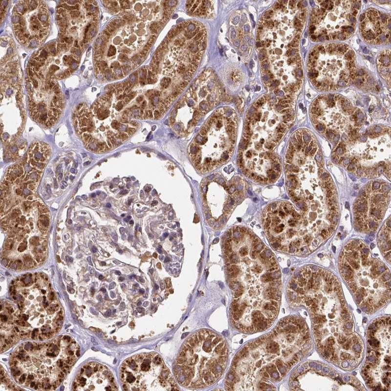 Anti-RNF123 Antibody