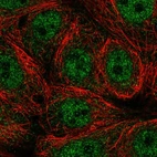 Anti-SEMA4A Antibody