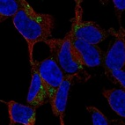 Anti-C1QTNF3 Antibody