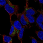 Anti-C1QTNF3 Antibody