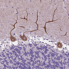 Anti-ADRA2B Antibody