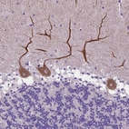 Anti-ADRA2B Antibody