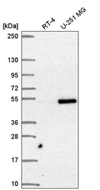 Anti-SNAPC3 Antibody
