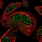Immunofluorescent staining of human cell line PC-3 shows localization to nucleoplasm.
