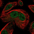 Immunofluorescent staining of human cell line PC-3 shows localization to nucleoplasm.