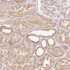 Anti-PRR26 Antibody