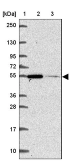 Lane 1: Marker [kDa] 250, 130, 95, 72, 55, 36, 28, 17, 10_br/_Lane 2: Human cell line RT-4_br/_Lane 3: Human cell line U-251 MG