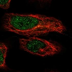 Immunofluorescent staining of human cell line HeLa shows localization to nucleoplasm & cytosol.