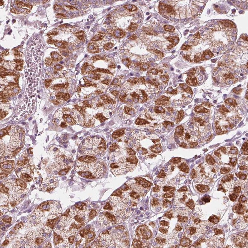 Anti-CLN6 Antibody