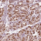 Anti-CLN6 Antibody
