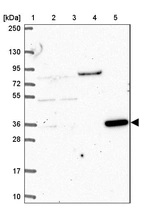 Lane 1: Marker [kDa] 250, 130, 95, 72, 55, 36, 28, 17, 10_br/_Lane 2: Human cell line RT-4_br/_Lane 3: Human cell line U-251 MG_br/_Lane 4: Human plasma_br/_Lane 5: Human Liver tissue