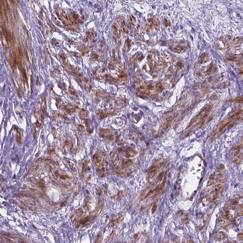 Anti-PFKFB4 Antibody
