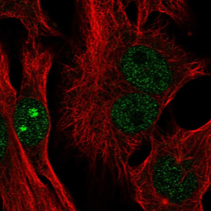 Anti-CTC-534A2.2 Antibody
