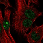 Anti-CTC-534A2.2 Antibody