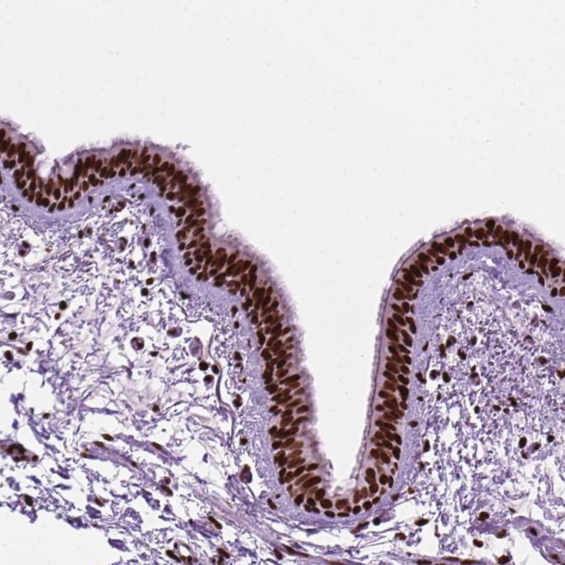 Anti-C9orf69 Antibody