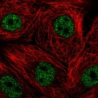 Immunofluorescent staining of human cell line MCF7 shows localization to nucleoplasm.