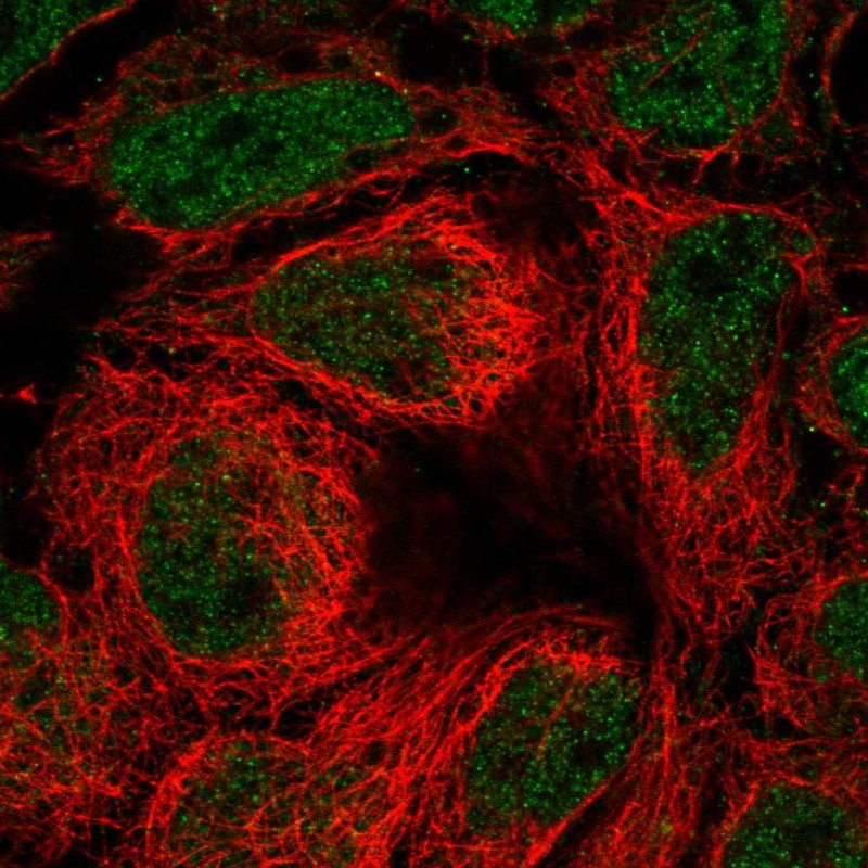 Anti-SLC39A10 Antibody