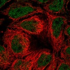 Anti-SLC39A10 Antibody