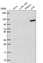 Western blot analysis in human cell line RT-4, human cell line U-251 MG, human plasma and human liver tissue.