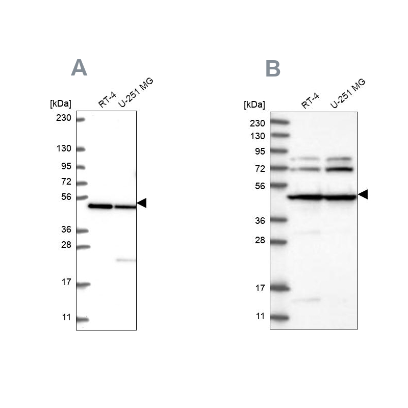 Anti-HADHB Antibody