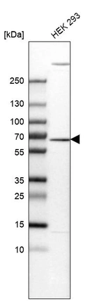 Anti-EDC3 Antibody