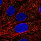 Immunofluorescent staining of human cell line MCF7 shows localization to cytoplasmic bodies.